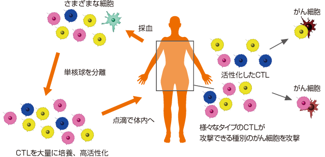 CAT療法図