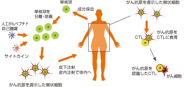 DC療法図